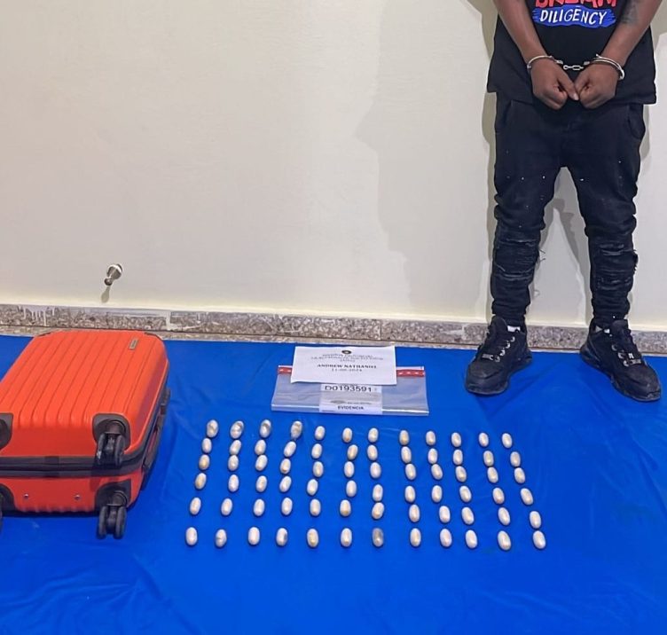 Detienen extranjero viajaría a Francia con estómago lleno de bolsitas presumiblemente cocaína