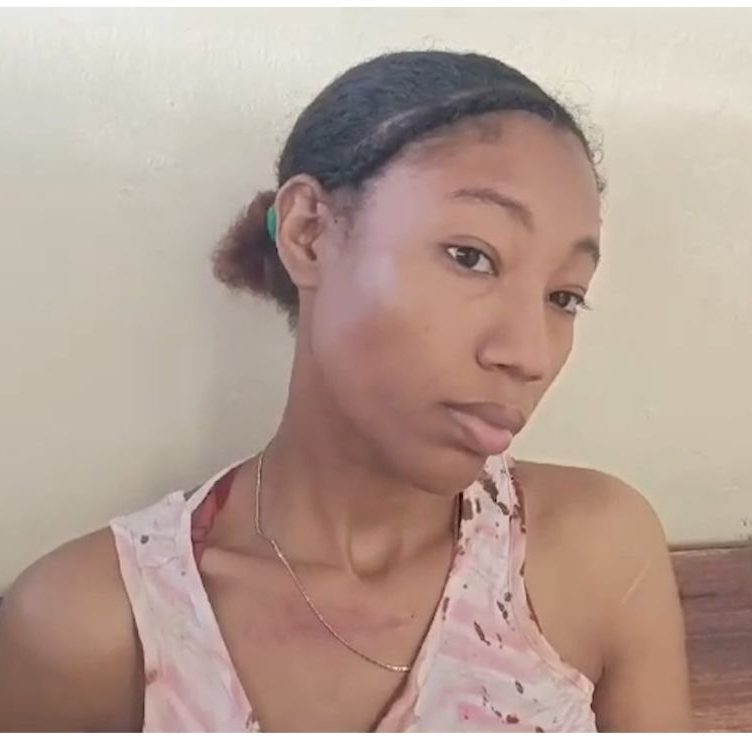 Mujer alega mató a su pareja por golpearla tras negarse a tener relaciones